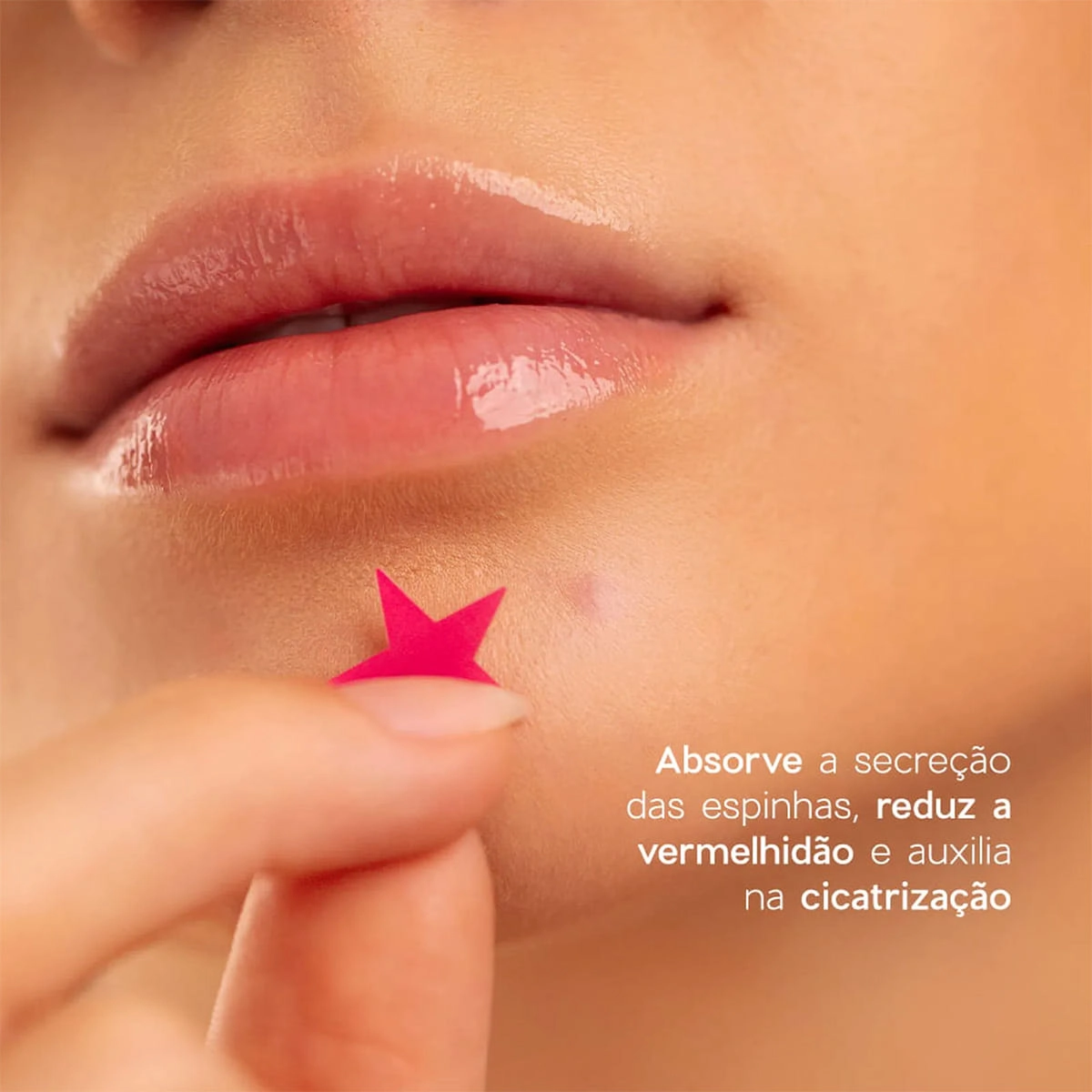 Produto: Adesivos Secativos para Espinhas Star 4You Océane 12 Unidades