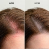 Thumbnail Kit_Keune_Scalp_Sensitive_-_Cuidado_Completo_para_Couro_Cabeludo_Sensivel_3_produtos_Evas_5 Thumbnail Kit_Keune_Scalp_Sensitive_-_Cuidado_Completo_para_Couro_Cabeludo_Sensivel_3_produtos_Evas_5